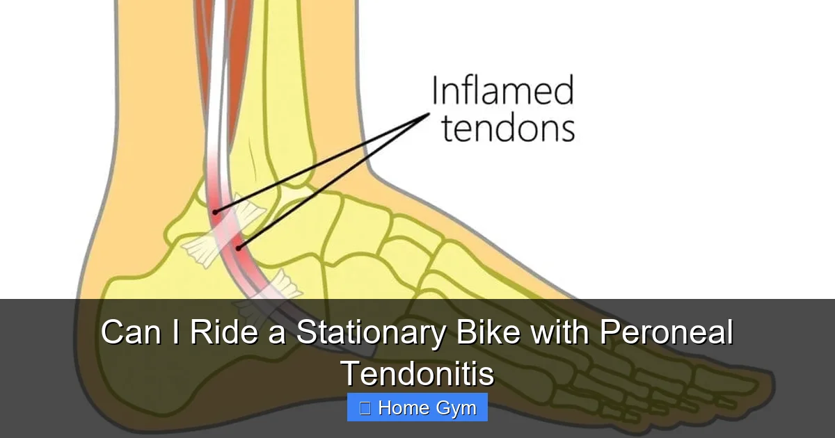 Can I Ride a Stationary Bike with Peroneal Tendonitis