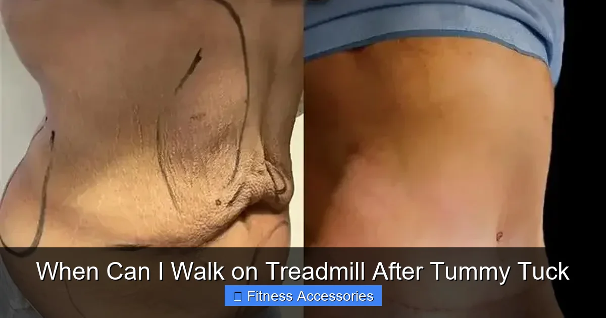When Can I Walk on Treadmill After Tummy Tuck